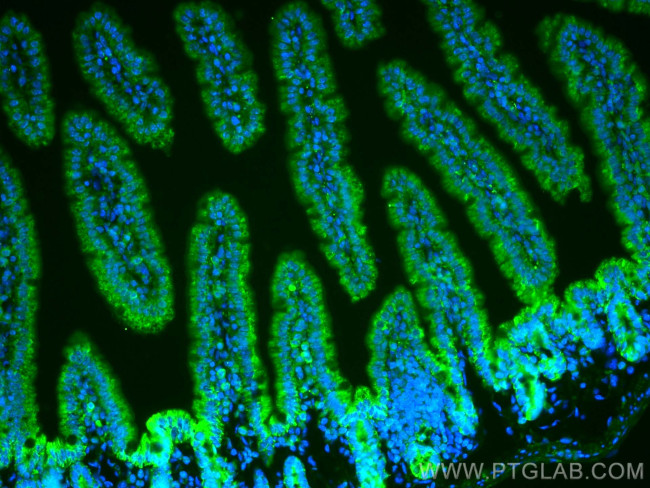DMT1 Antibody in Immunohistochemistry (PFA fixed) (IHC (PFA))