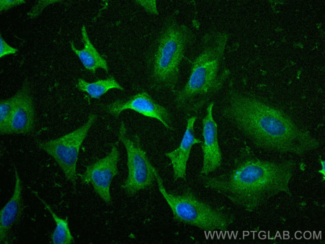 PRDX1 Antibody in Immunocytochemistry (ICC/IF)