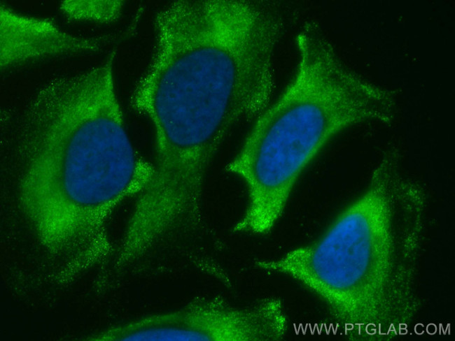 mDia1 Antibody in Immunocytochemistry (ICC/IF)