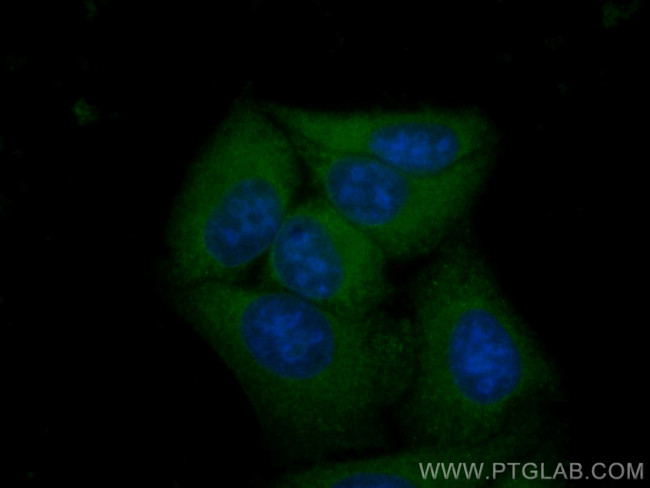 CXCR2 Antibody in Immunocytochemistry (ICC/IF)