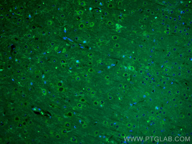 PSD95, DLG4 Antibody in Immunohistochemistry (PFA fixed) (IHC (PFA))