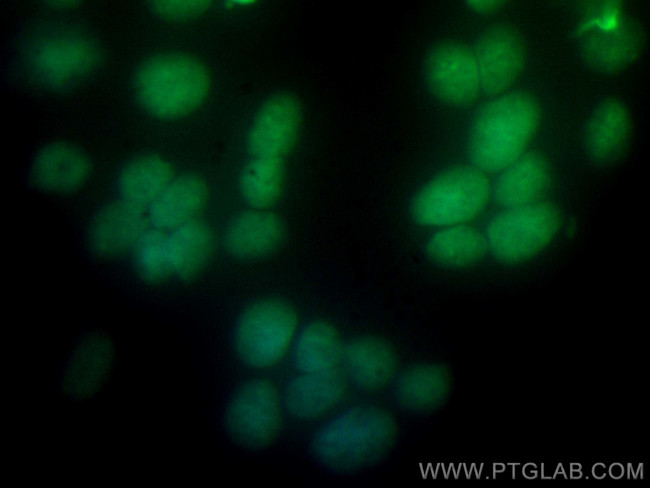 RUNX2 Antibody in Immunocytochemistry (ICC/IF)