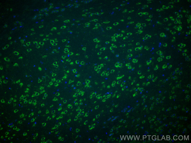 TMC1 Antibody in Immunohistochemistry (PFA fixed) (IHC (PFA))