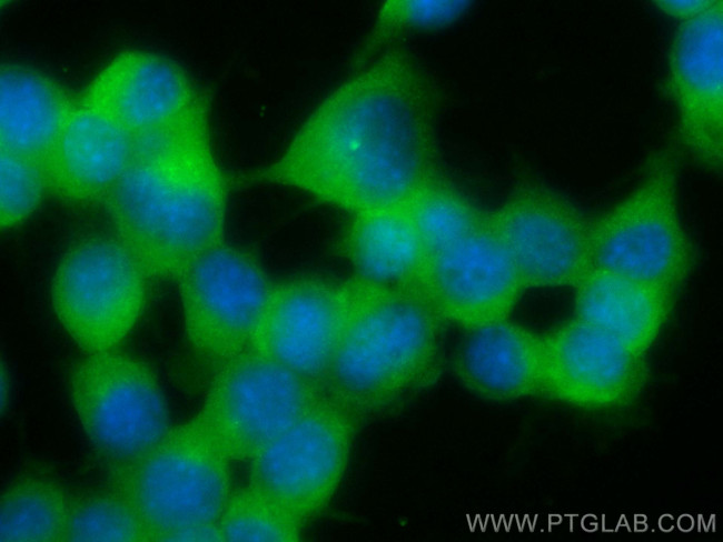 GLAST Antibody in Immunocytochemistry (ICC/IF)