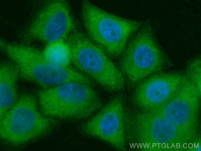 WDR55 Antibody in Immunocytochemistry (ICC/IF)