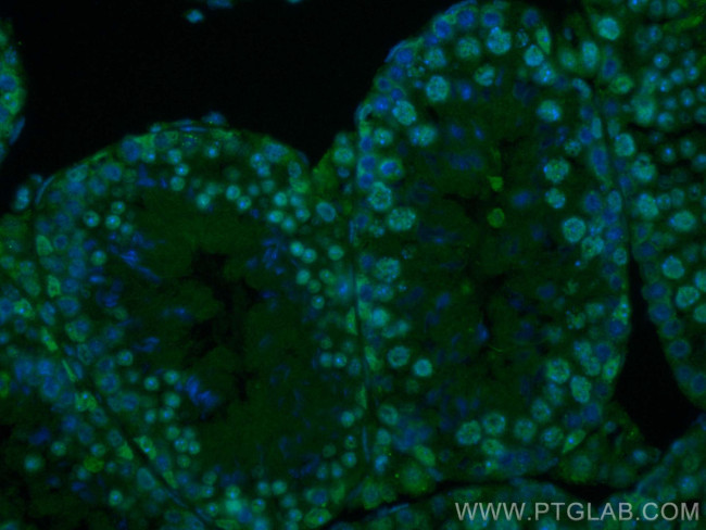TCERG1L Antibody in Immunohistochemistry (PFA fixed) (IHC (PFA))