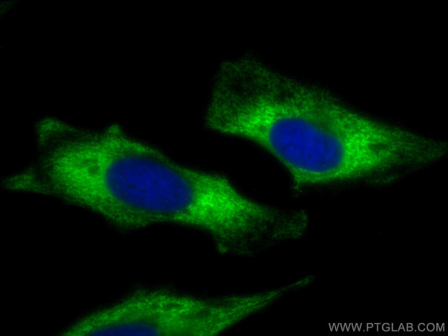 PKC Epsilon Antibody in Immunocytochemistry (ICC/IF)