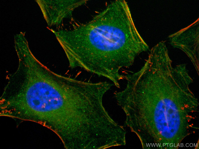 Caldesmon Antibody in Immunocytochemistry (ICC/IF)