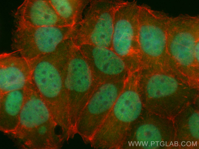 PHIP Antibody in Immunocytochemistry (ICC/IF)