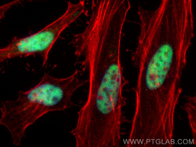 KLF5 Antibody in Immunocytochemistry (ICC/IF)