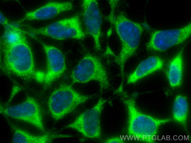 UBXD2 Antibody in Immunocytochemistry (ICC/IF)