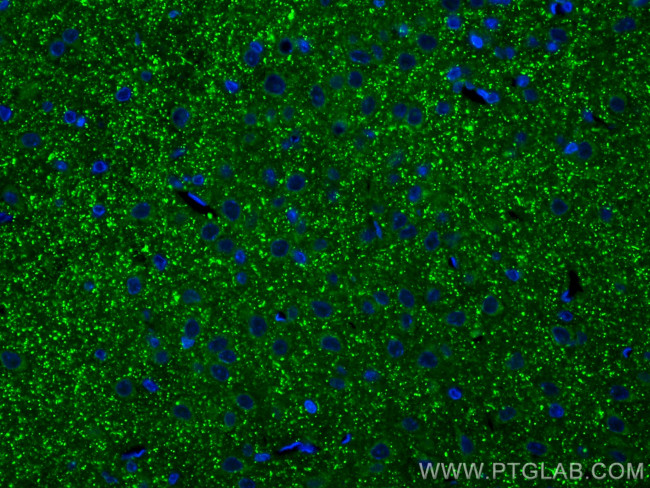 Synaptopodin Antibody in Immunohistochemistry (PFA fixed) (IHC (PFA))