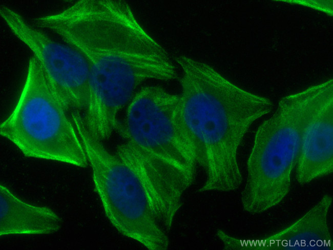 CNN2 Antibody in Immunocytochemistry (ICC/IF)
