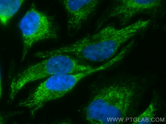 CHCHD4 Antibody in Immunocytochemistry (ICC/IF)