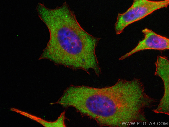 SH3BGR Antibody in Immunocytochemistry (ICC/IF)