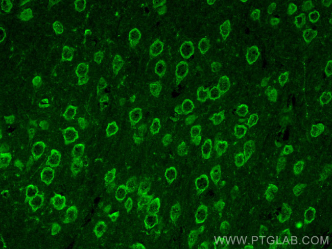 Kv4.2 Antibody in Immunohistochemistry (PFA fixed) (IHC (PFA))