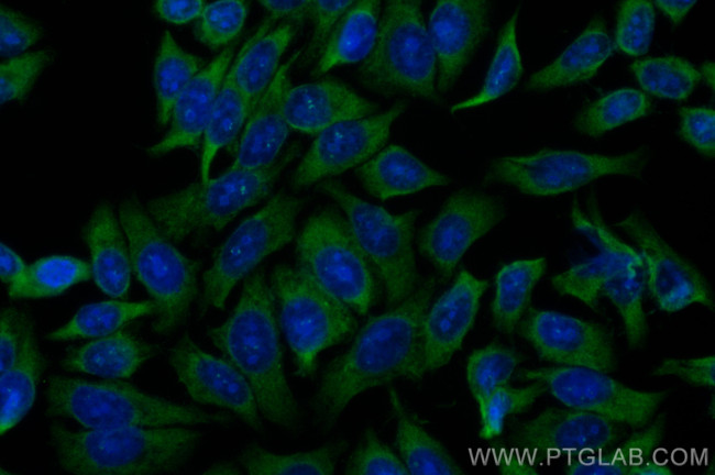 C5aR Antibody in Immunocytochemistry (ICC/IF)