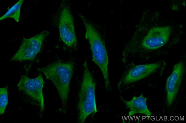 C3/C3b/C3c Antibody in Immunocytochemistry (ICC/IF)