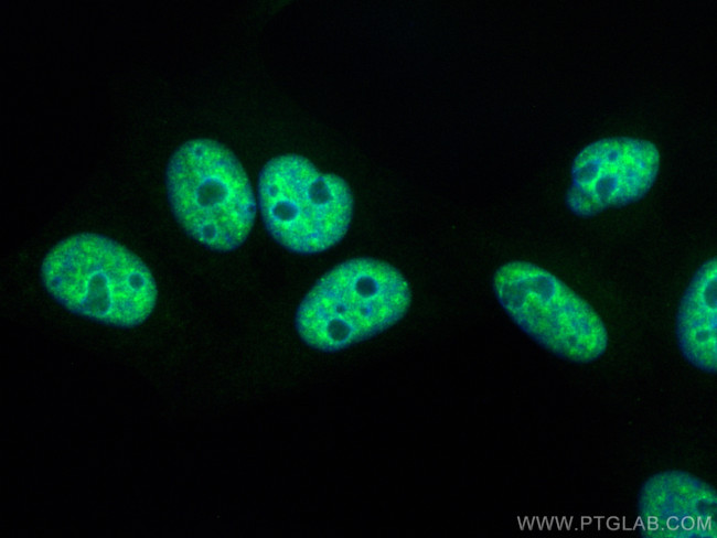 SR140 Antibody in Immunocytochemistry (ICC/IF)
