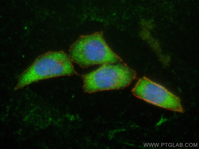 MYH10 Antibody in Immunocytochemistry (ICC/IF)
