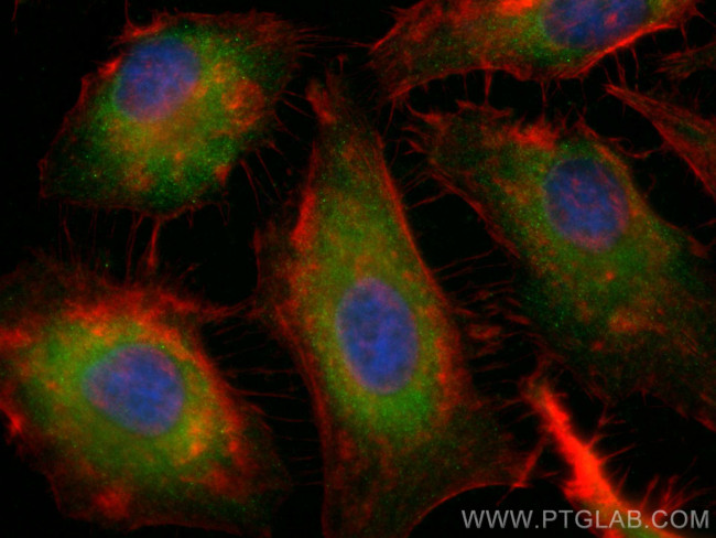 SMMHC Antibody in Immunocytochemistry (ICC/IF)