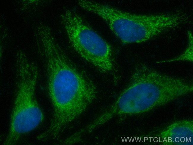 MRPL28 Antibody in Immunocytochemistry (ICC/IF)