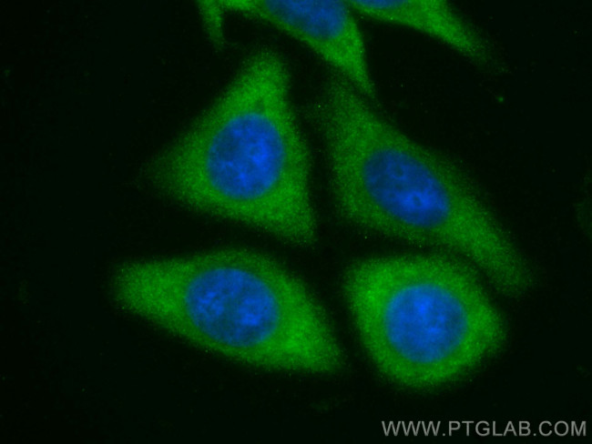 KIF5B Antibody in Immunocytochemistry (ICC/IF)
