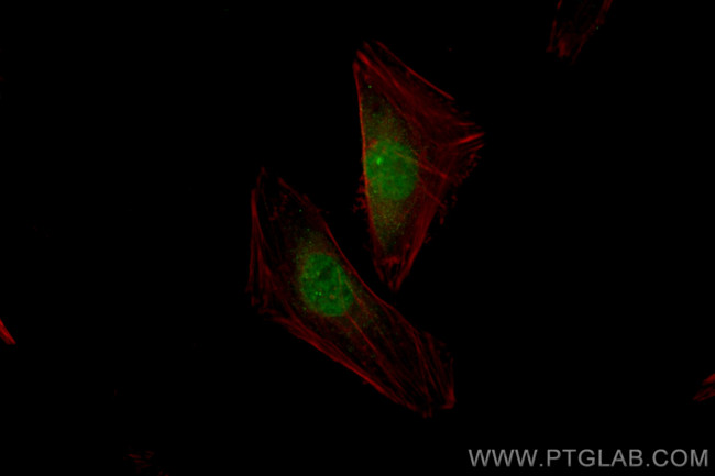 GBX2 Antibody in Immunocytochemistry (ICC/IF)