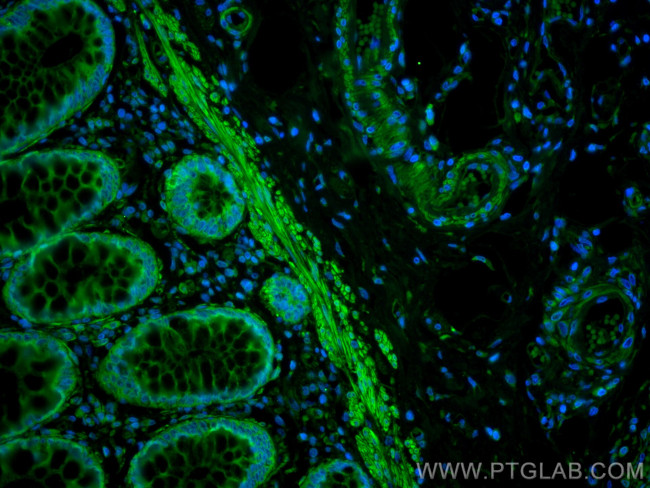 MYLK Antibody in Immunohistochemistry (Paraffin) (IHC (P))