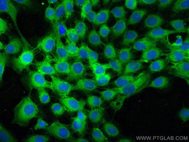 Integrin Beta 4 Antibody in Immunocytochemistry (ICC/IF)