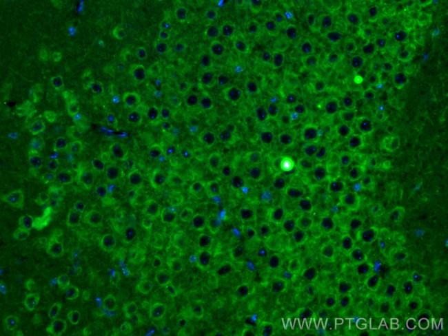 L-VOCC Antibody in Immunohistochemistry (PFA fixed) (IHC (PFA))