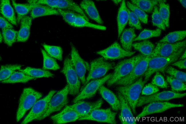LDHA Antibody in Immunocytochemistry (ICC/IF)