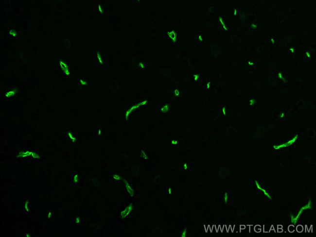 GLUT1 Antibody in Immunohistochemistry (PFA fixed) (IHC (PFA))