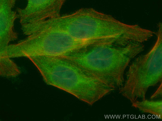 NR3C2 Antibody in Immunocytochemistry (ICC/IF)