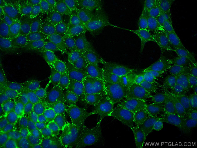 DSG2 Antibody in Immunocytochemistry (ICC/IF)