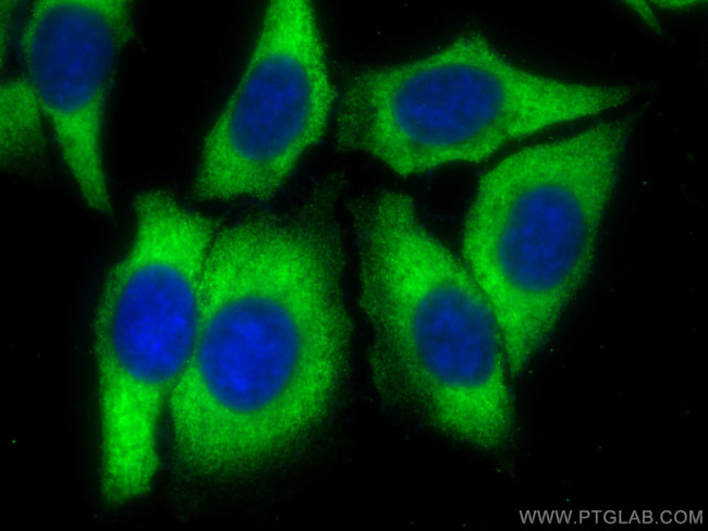 Sclerostin Antibody in Immunocytochemistry (ICC/IF)