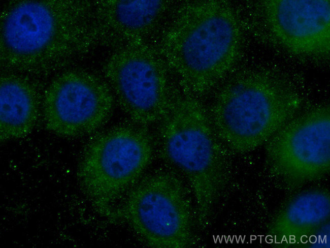 FUT4 Antibody in Immunocytochemistry (ICC/IF)
