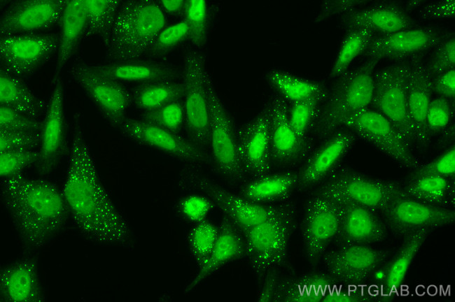 YY1 Antibody in Immunocytochemistry (ICC/IF)