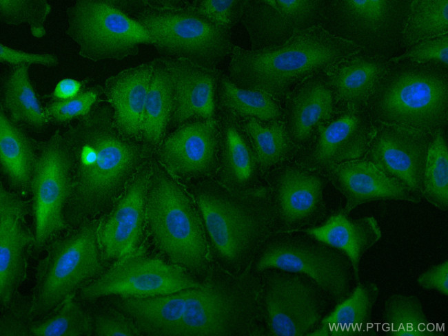 IQGAP1 Antibody in Immunocytochemistry (ICC/IF)