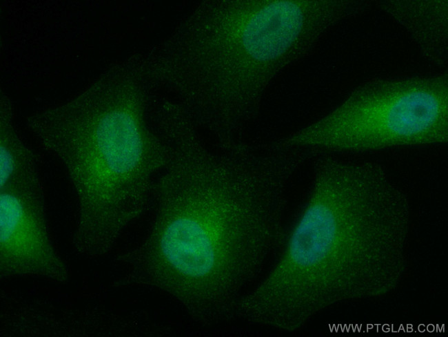REST Antibody in Immunocytochemistry (ICC/IF)