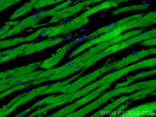MYH6 Antibody in Immunohistochemistry (PFA fixed) (IHC (PFA))