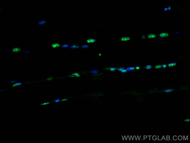TCF4 Antibody in Immunohistochemistry (PFA fixed) (IHC (PFA))