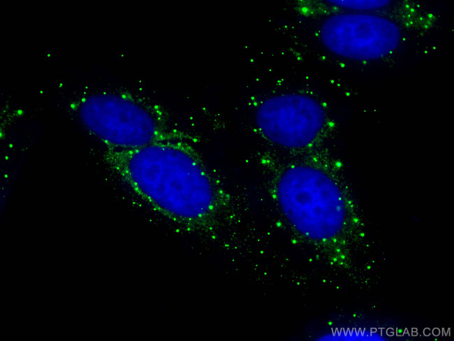 DCP1A Antibody in Immunocytochemistry (ICC/IF)