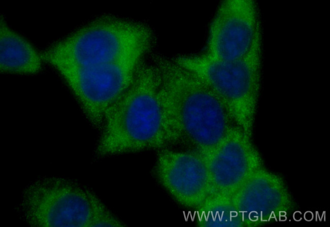 RNASEL Antibody in Immunocytochemistry (ICC/IF)