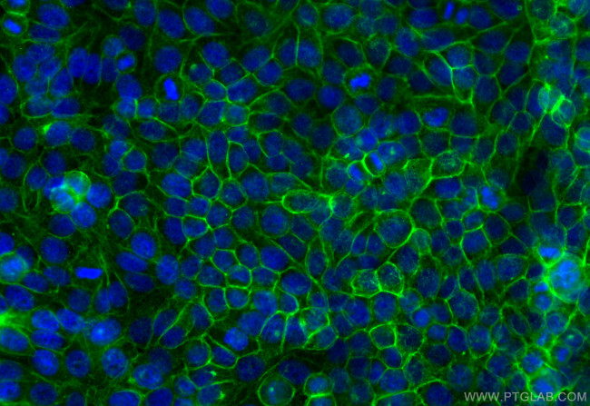 MCT4 Antibody in Immunocytochemistry (ICC/IF)