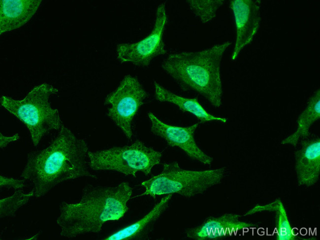 PHLPP Antibody in Immunocytochemistry (ICC/IF)