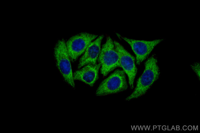 CCS Antibody in Immunocytochemistry (ICC/IF)