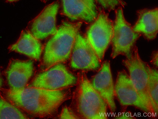 IGF2BP1 Antibody in Immunocytochemistry (ICC/IF)