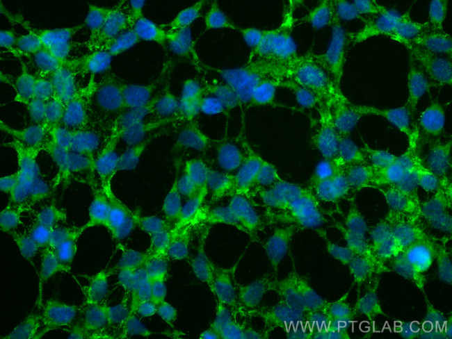 KCNN4 Antibody in Immunocytochemistry (ICC/IF)