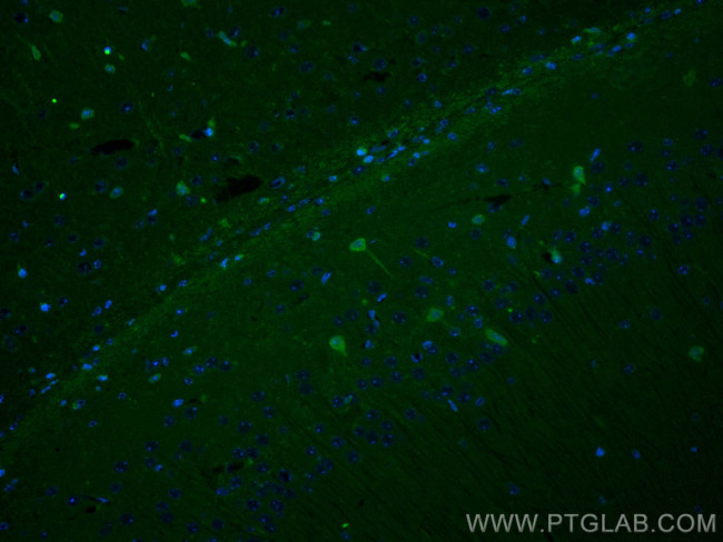 PINK1 Antibody in Immunohistochemistry (PFA fixed) (IHC (PFA))